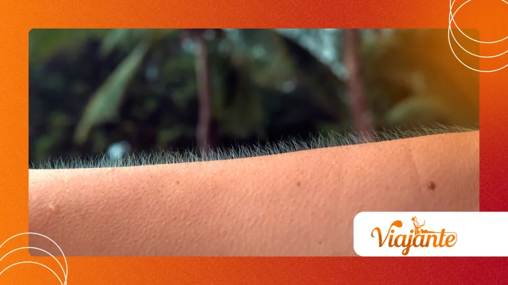 Why Do We Get Goosebumps