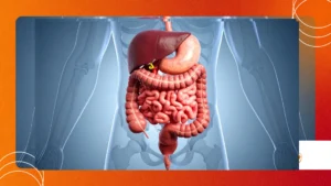 Gut Fungi (Mycobiome): The Unexplored Frontier